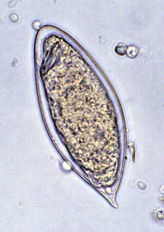 schistosomiasis picture