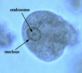 Amebas - Diagnostic Parasitology